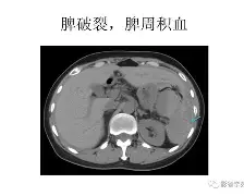 爱游戏-納貢遭受腹部傷勢，損失無法突破